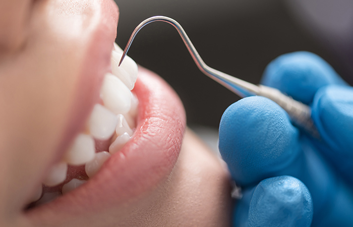 初期治療・セルフケア指導