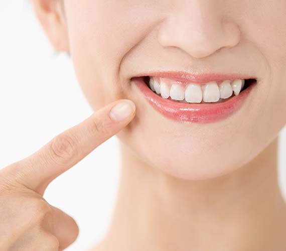 審美修復（詰め物）